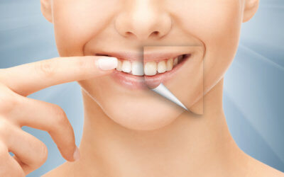 5 Types of Cosmetic Dentistry Services in Columbia, SC
